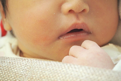 ヘルパンギーナとは